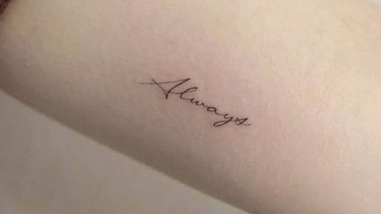 Always sur le bras