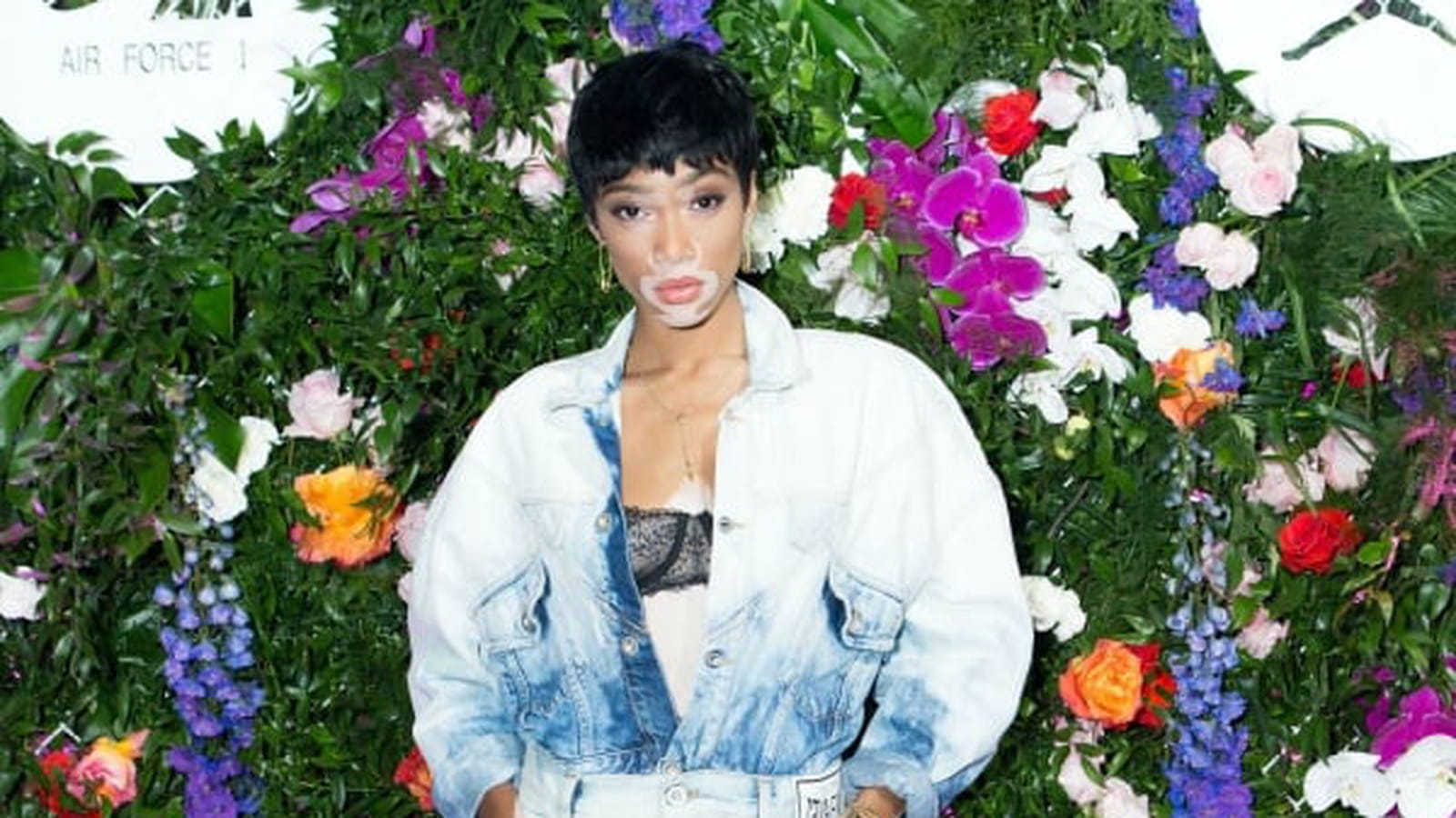 Winnie Harlow