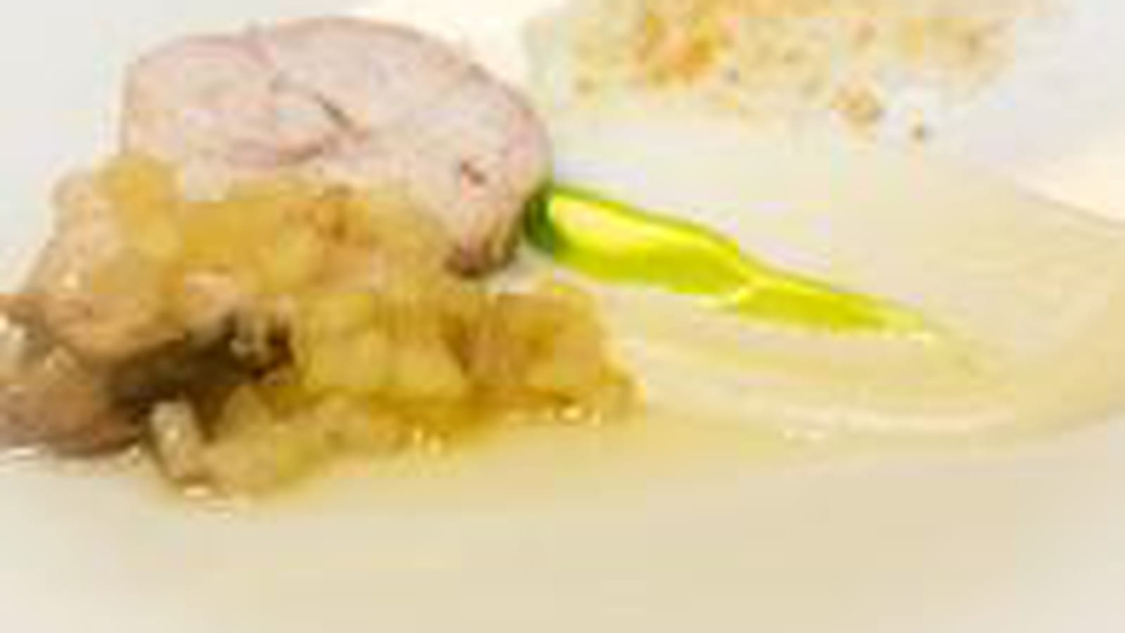 Ris de veau