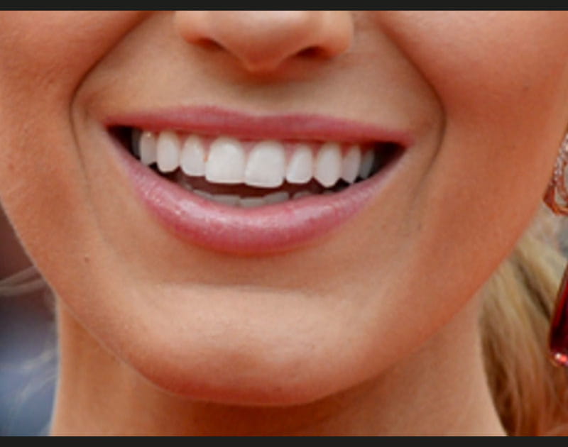 A qui sont ces jolies l&egrave;vres ?