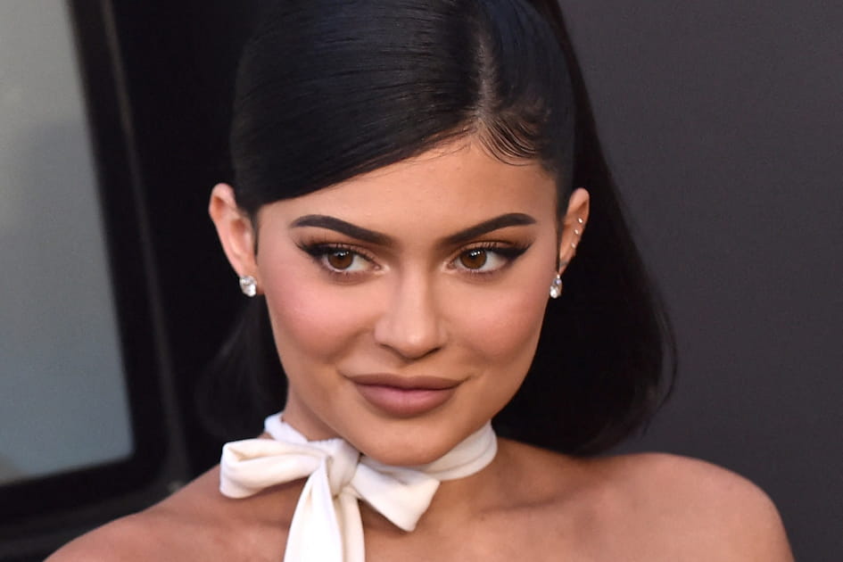 Kylie Jenner, apr&egrave;s&nbsp;: une bouche surgonfl&eacute;e