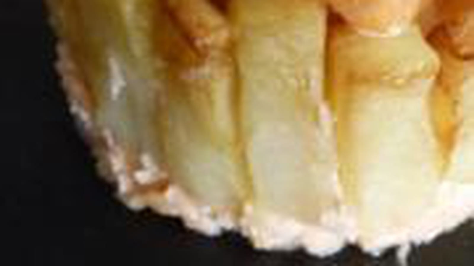 Charlotte de pommes de terre