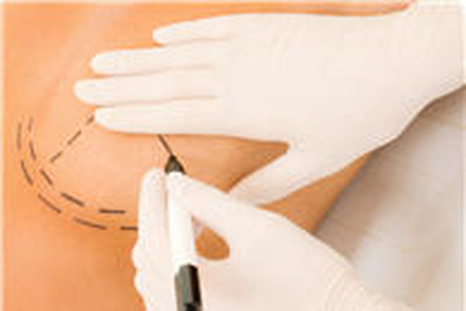 Implants PIP : le gouvernement recommande le retrait