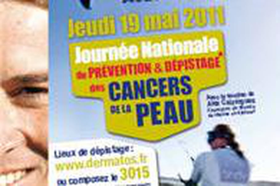 Jeudi 19, une Journée pour dépister les cancers de la peau