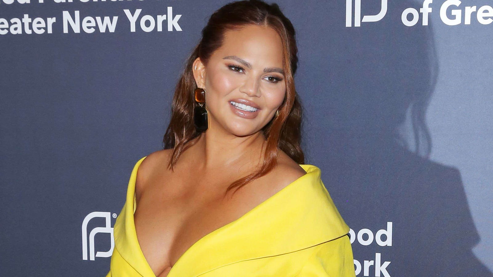 Chrissy Teigen
