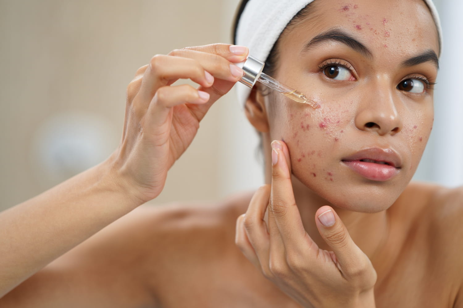 This very effective product against acne hides a risk that few people know