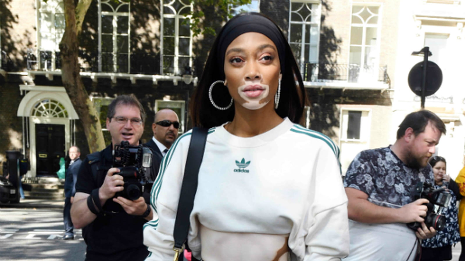 Winnie Harlow 