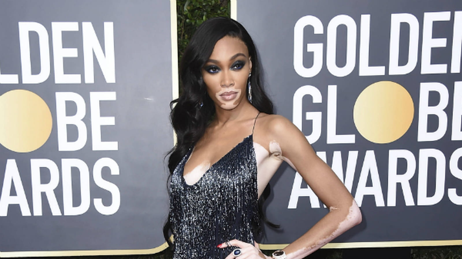 Winnie Harlow 