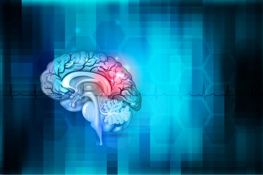 Métastases au cerveau : signes, traitement, espérance de vie
