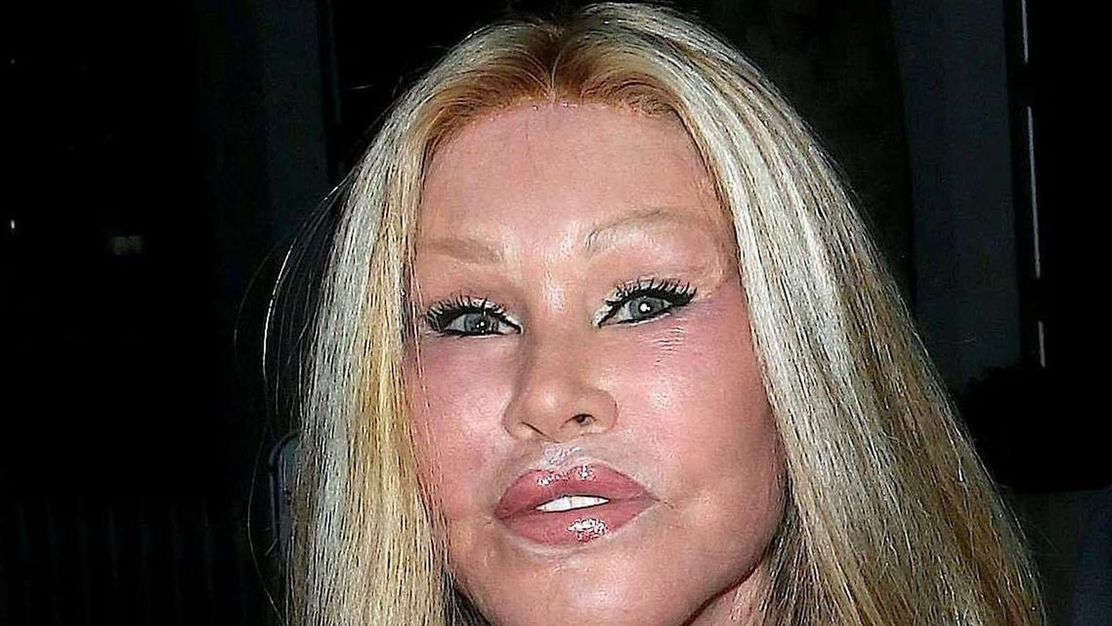 Jocelyn Wildenstein