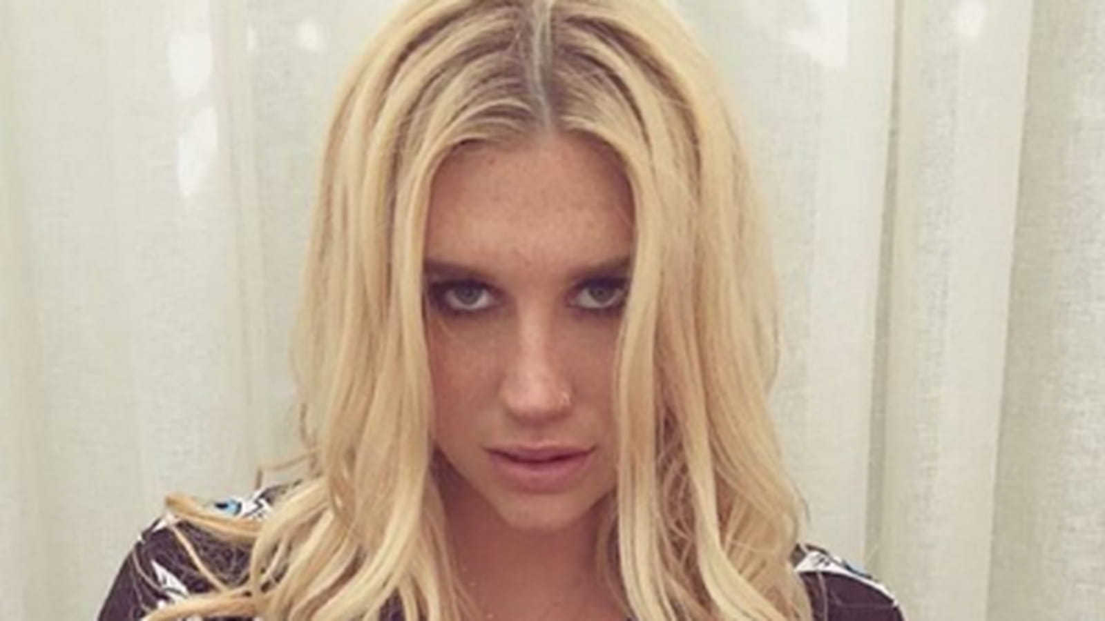 Kesha