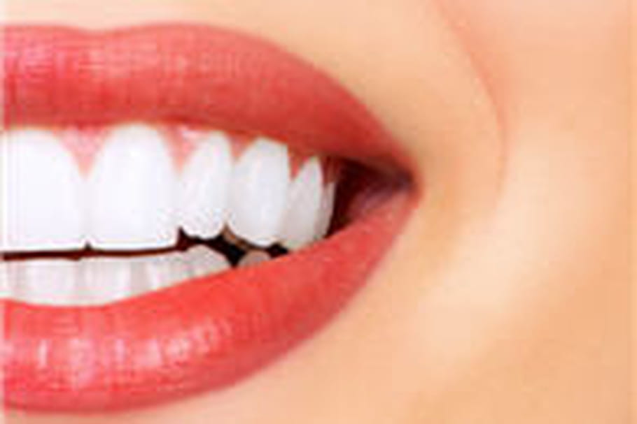 Blanchiment dentaire : oui, mais chez le dentiste !
