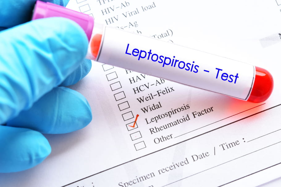 Leptospirose : symptômes et traitements de la maladie du rat