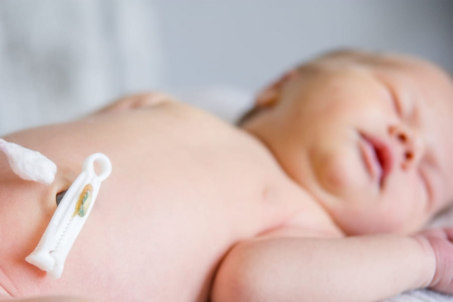 Soins du cordon ombilical : comment le nettoyer ?