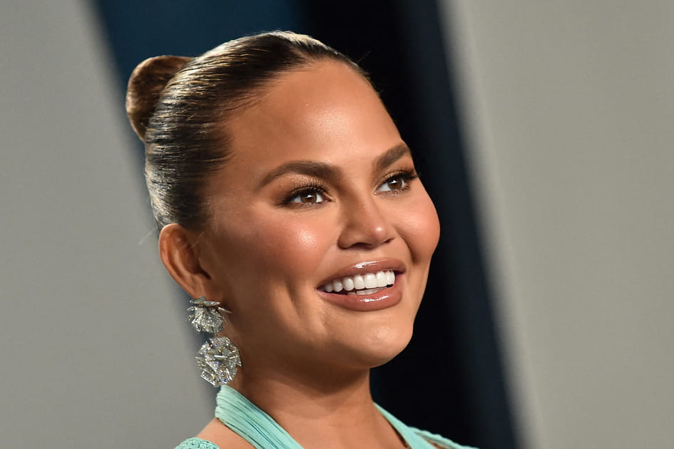 Chrissy Teigen, apr&egrave;s&nbsp;: des l&egrave;vres &eacute;paisses