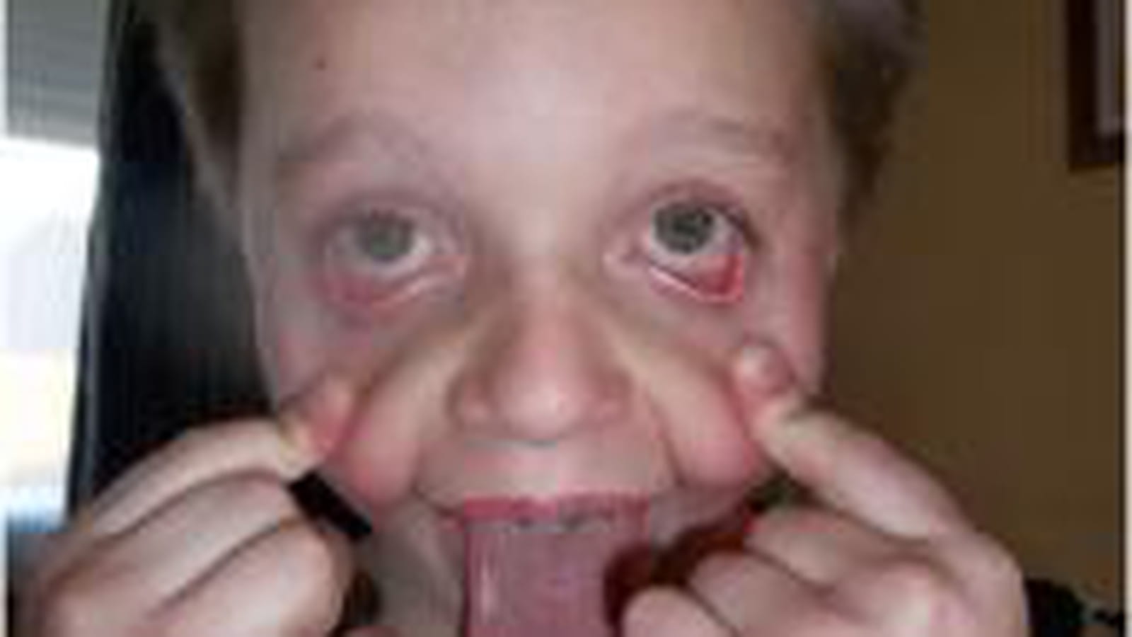 Janin, grimaceur professionnel
