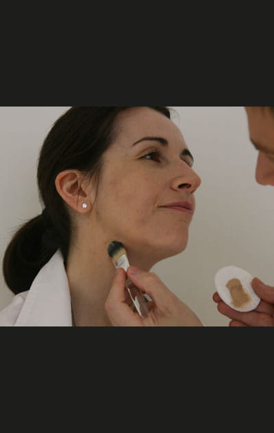 Camoufler ses boutons&nbsp;: l'application du fond de teint