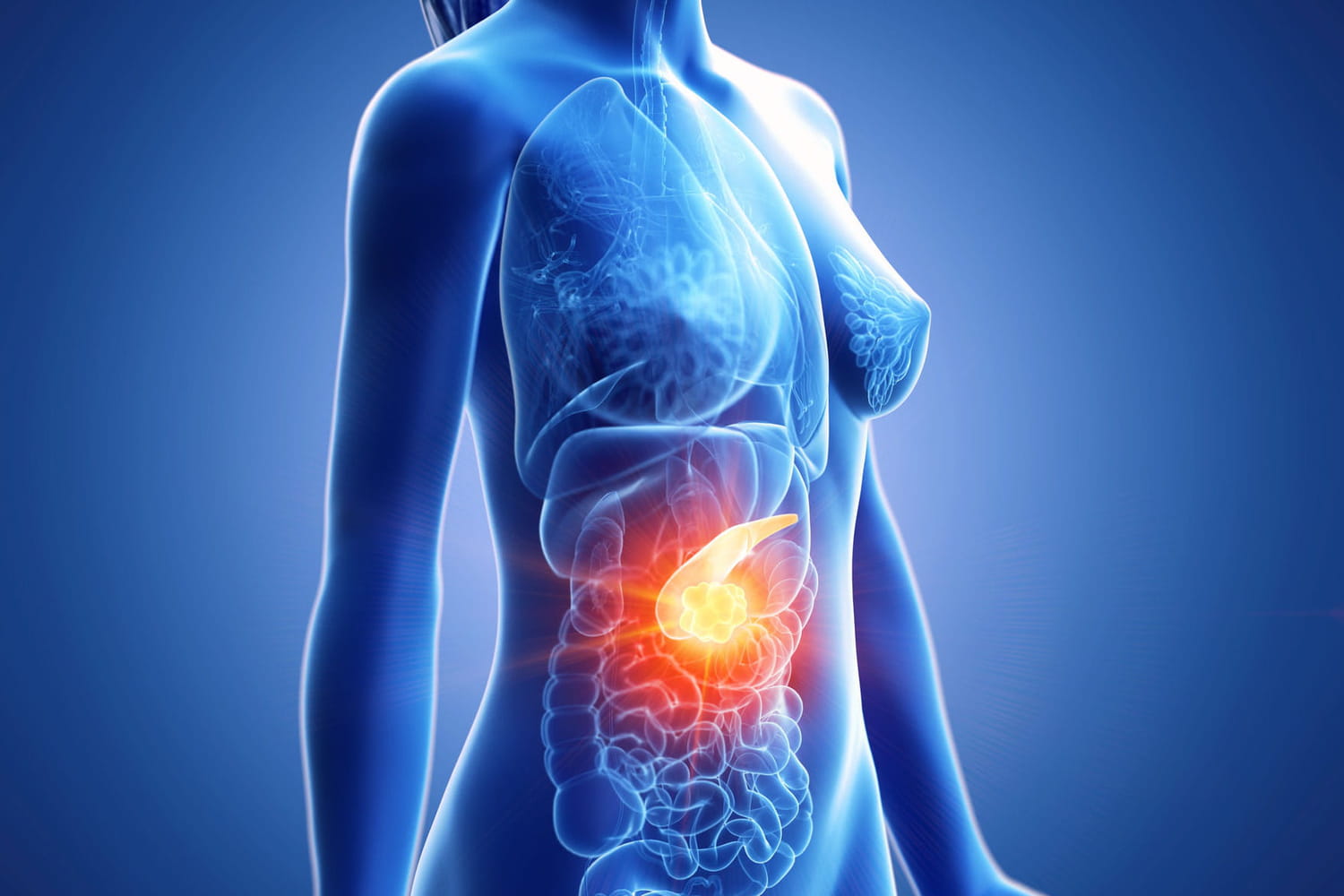 Quel Est Le Cancer Le Plus Dangereux Cancer foudroyant : c'est quoi, symptômes, traitements