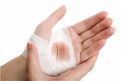 le sang des hémophiles souffre d'un problème de coagulation.