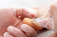 Ongle Pousse Composition Schema Maladies