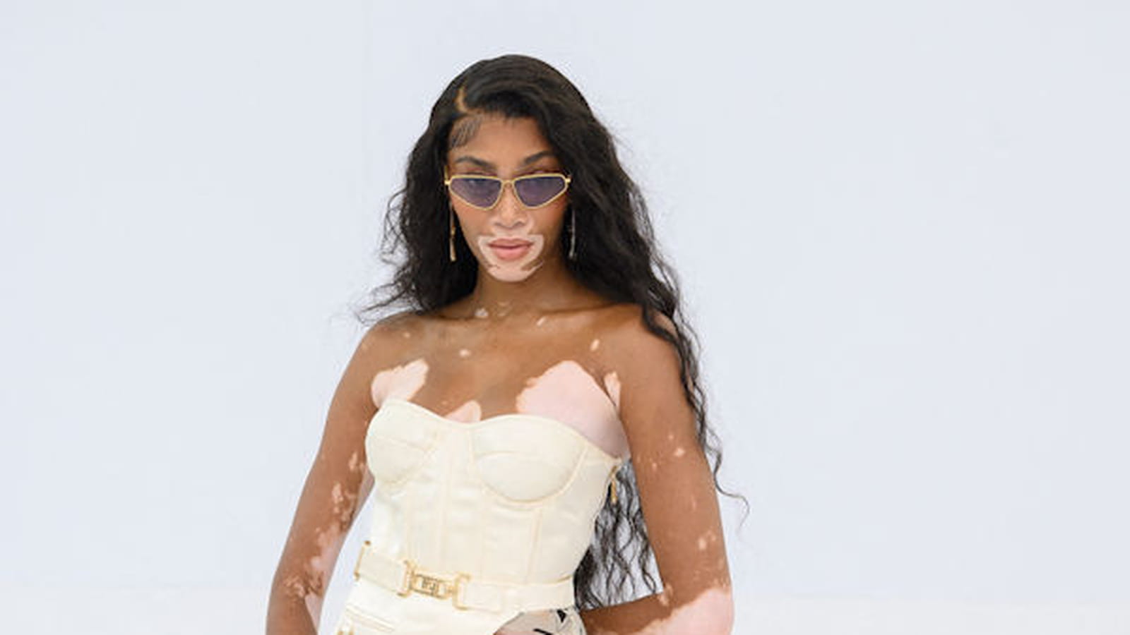 Winnie Harlow