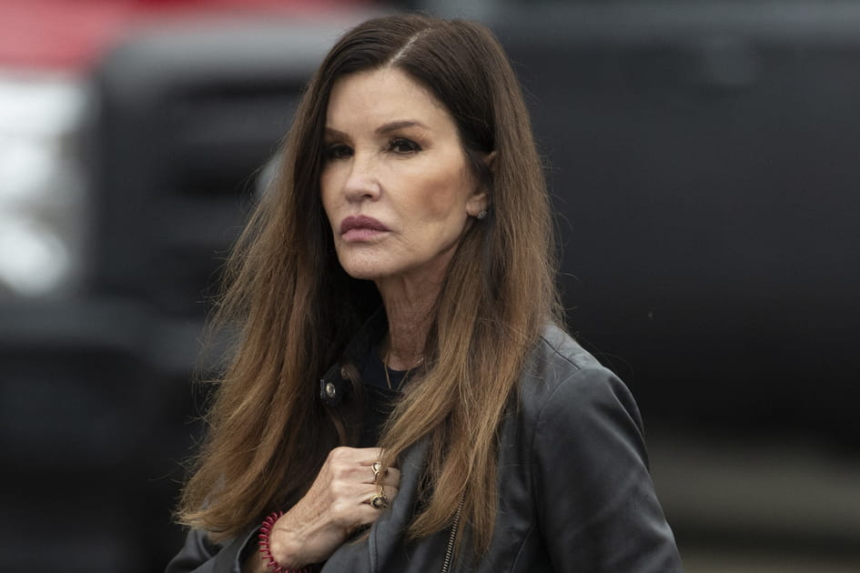 Janice Dickinson, apr&egrave;s&nbsp;: une bouche difforme