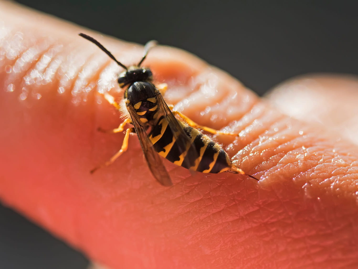 Wasp sting: photo, swelling, what to do? Wasp sting: photo, swelling, what to do?