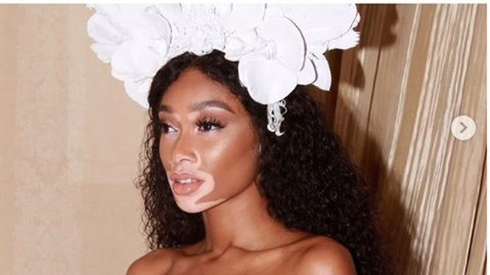 Winnie Harlow
