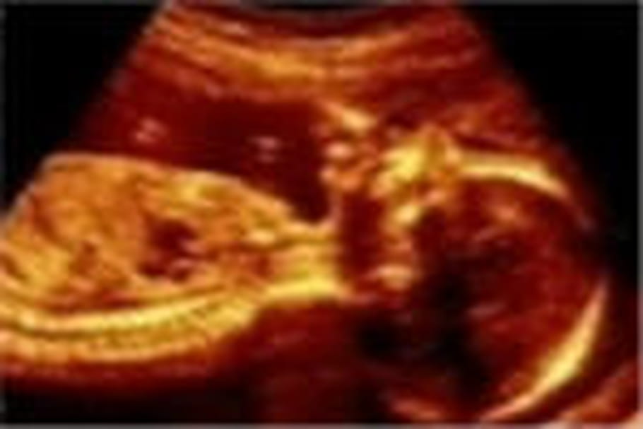 Echographies 3D et 4D : des risques pour le foetus