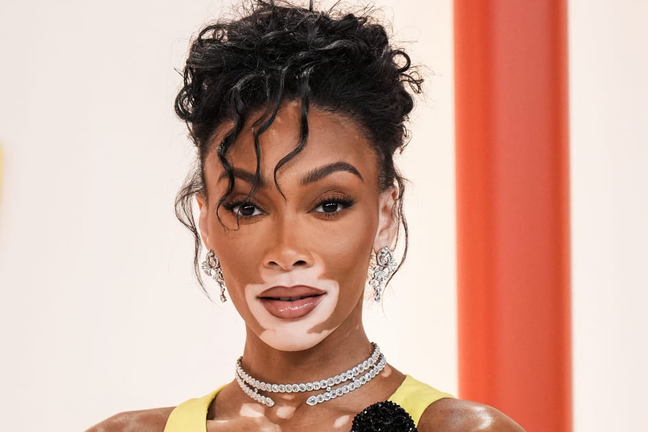 Winnie Harlow, remarquable avec son chignon coigg&eacute;-d&eacute;coiff&eacute;