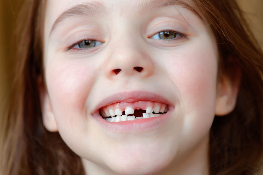 Dents de lait : apparition, nombre, âge de la perte