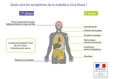 infographie : les symptômes d'ebola.