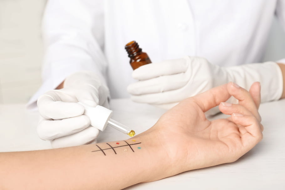 Allergie à la pénicilline : test, réaction, alternatives, antibiotiques