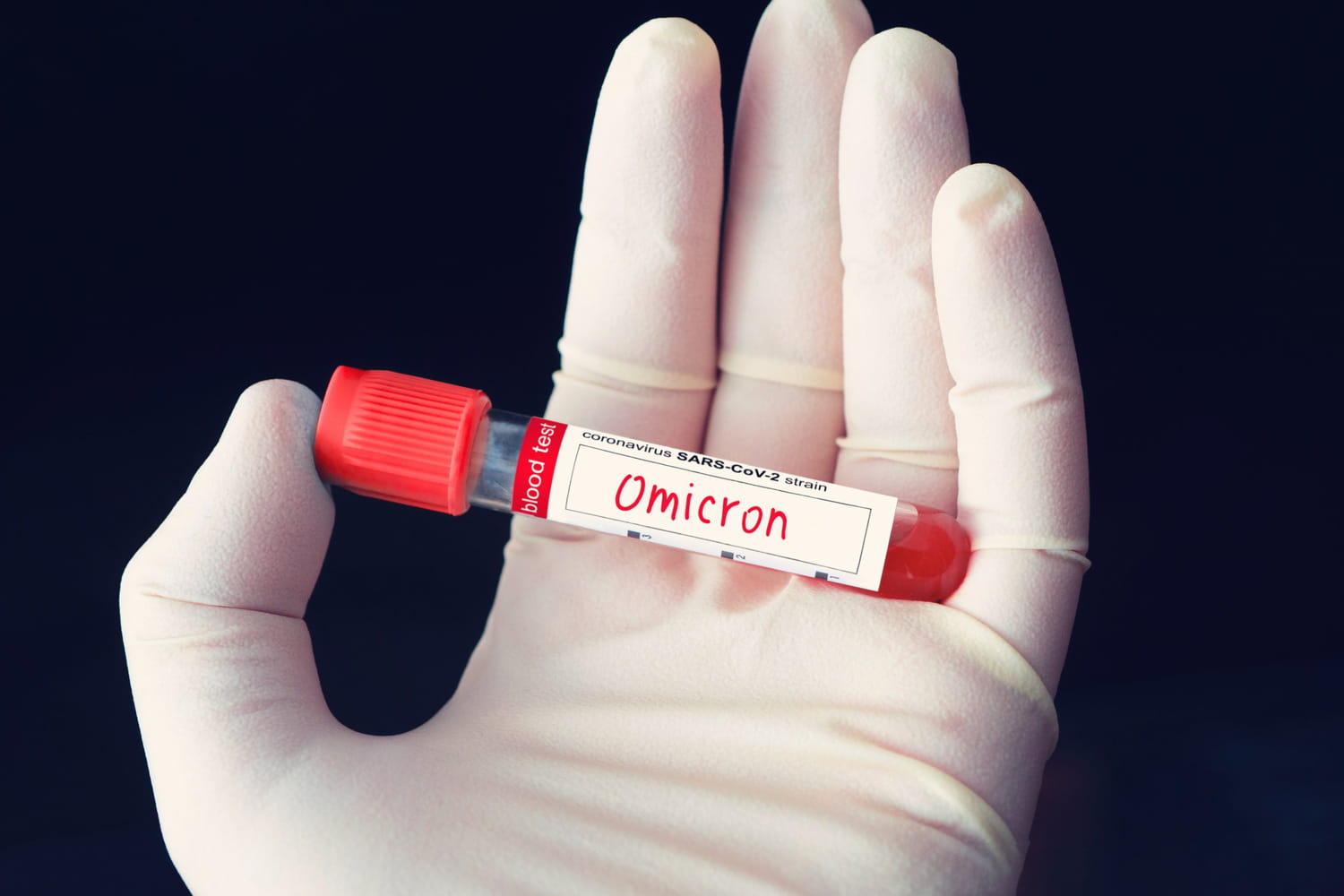 Variant Covid : actuel, mutation L452, K417N, c'est quoi ?