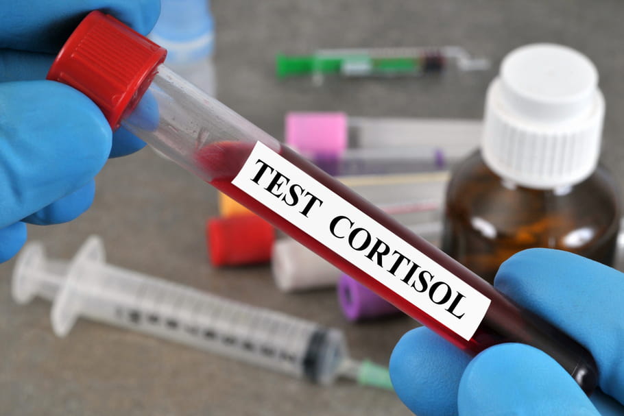 Cortisol bas, élevé dans le sang : normes, que faire ?