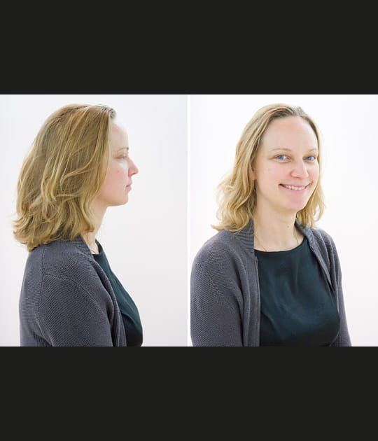 Chryst&egrave;le, avant