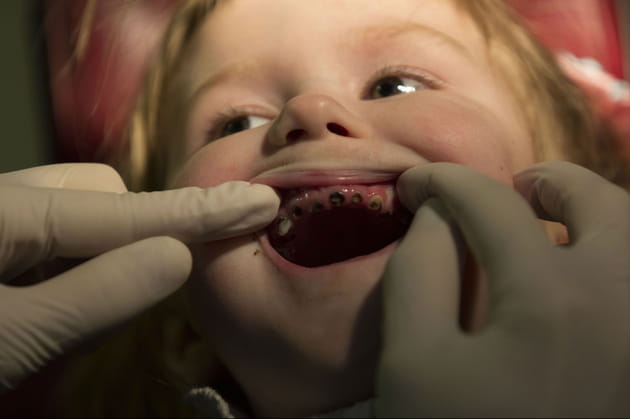 Iana, 4 ans, se fait examiner