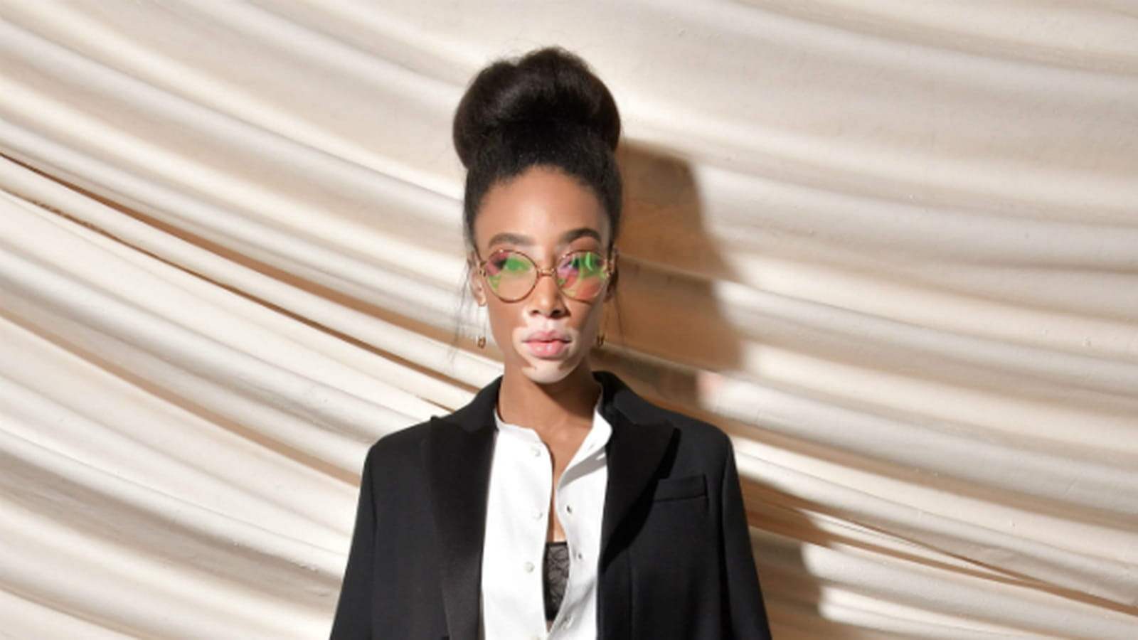 Winnie Harlow
