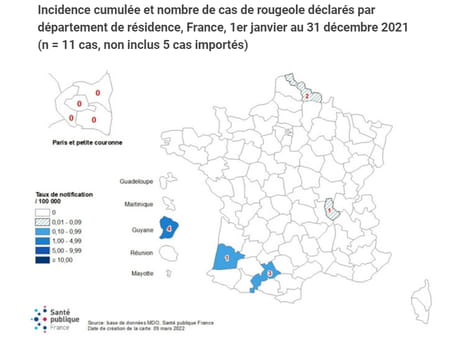 incidence Rougeole par département en France en 2021