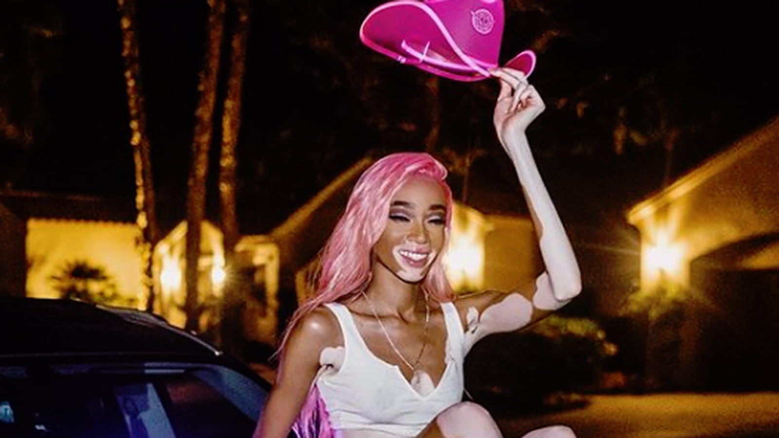 Winnie Harlow