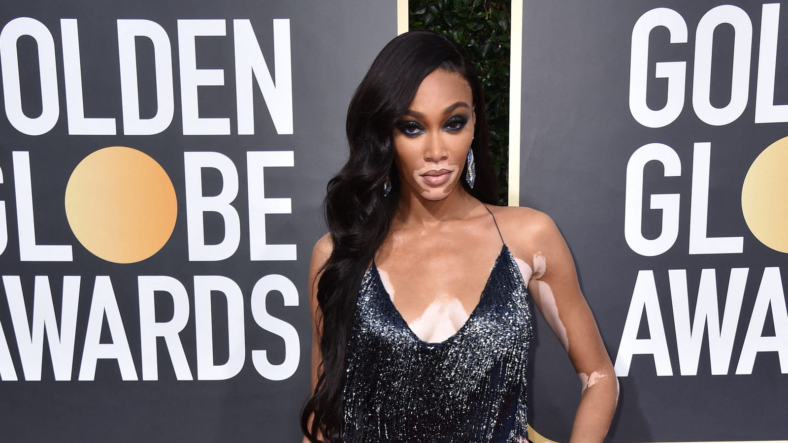 Winnie Harlow