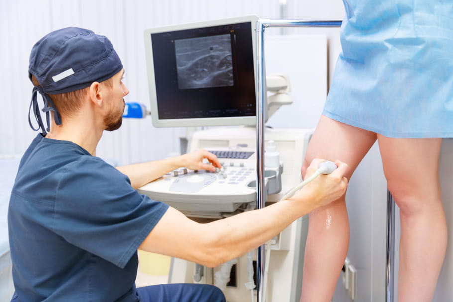 Varices : symptômes, causes et traitements