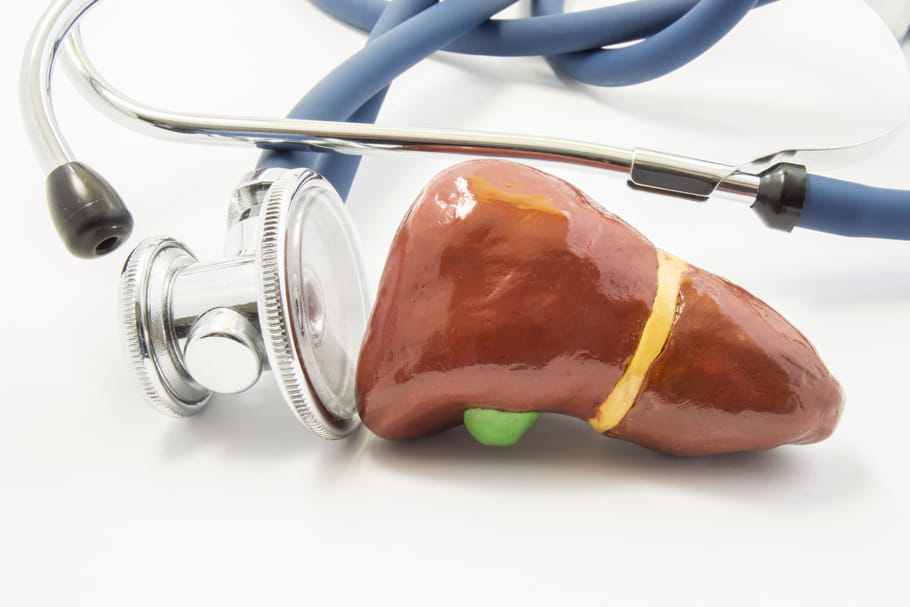 Fibrose hépatique : traitement, stade, réversible ou pas ?