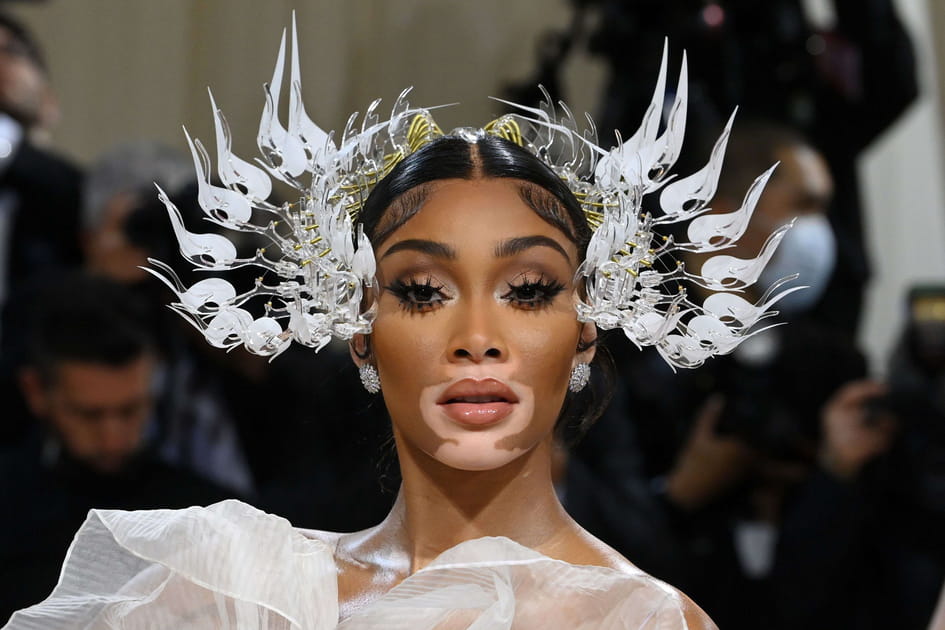 Le look de d&eacute;esse de Winnie Harlow