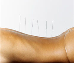 l'acupuncture aide à soulager des maux très variés, des troubles digestifs aux