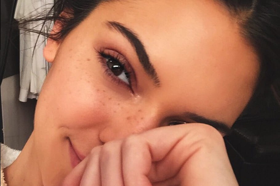 Kendall Jenner craque pour les taches de rousseur