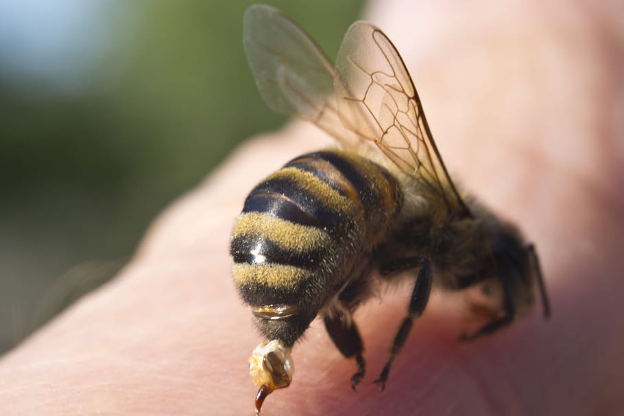 Piqûre d'abeille : comment la soulager ?
