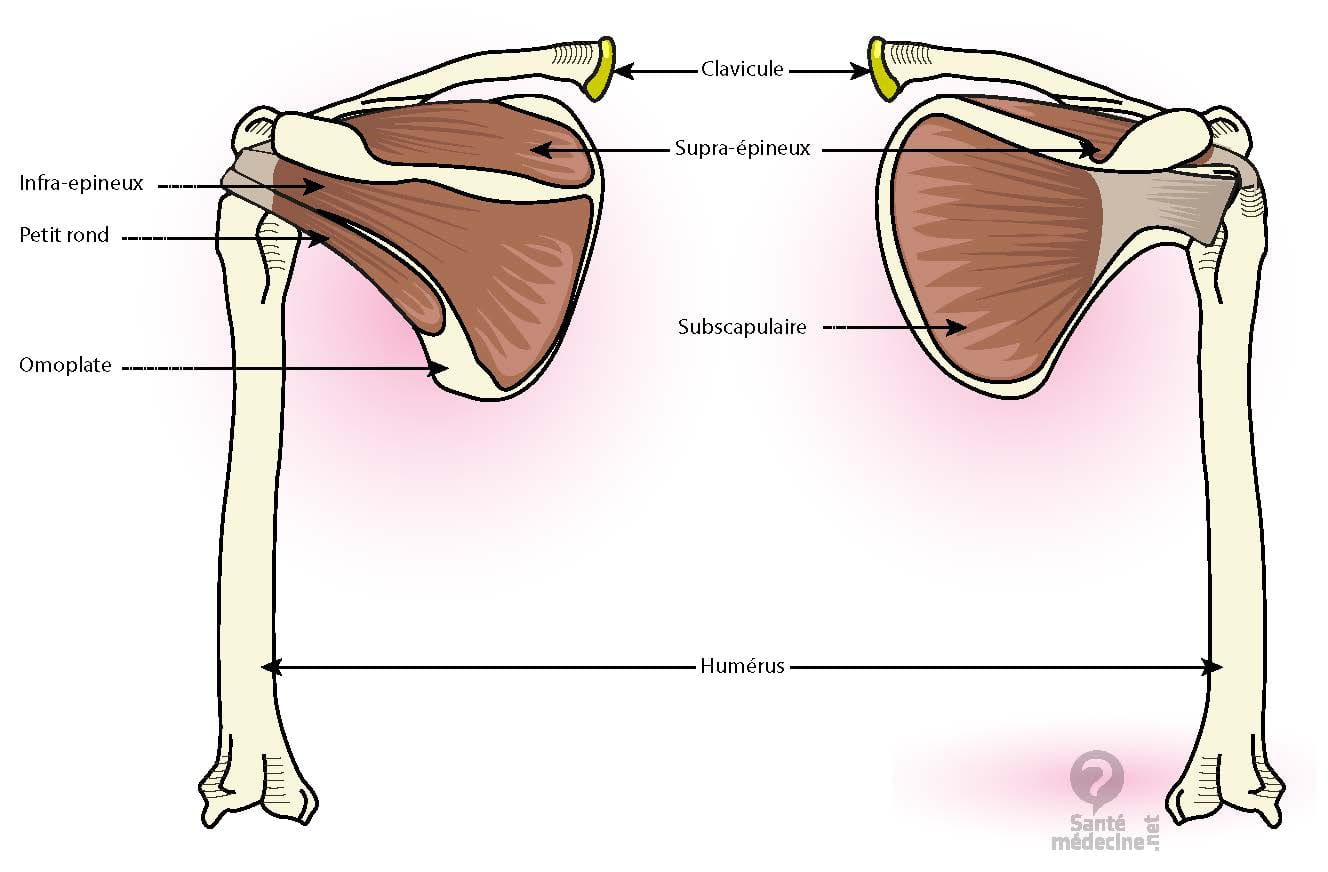 Rupture Transfixiante Du Tendon Supra épineux Maladie Professionnelle