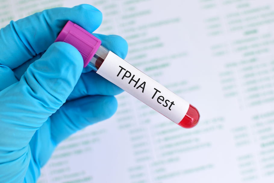 TPHA : indications, sérologie, test positif ou négatif