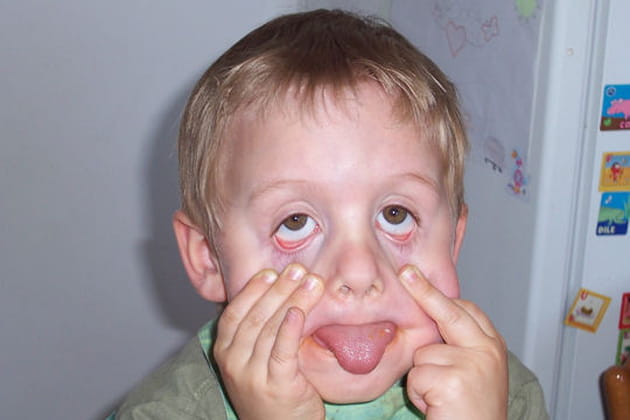 Les yeux ronds comme des billes